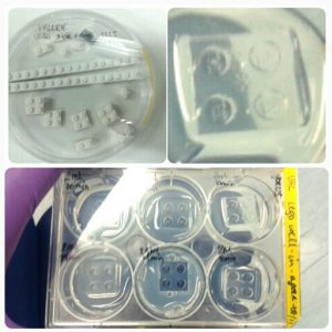 Top left: lego blocks in a petridish. Top right: a bit of agar molded by lego. Bottom: a 6 well plates with molded lego-wells