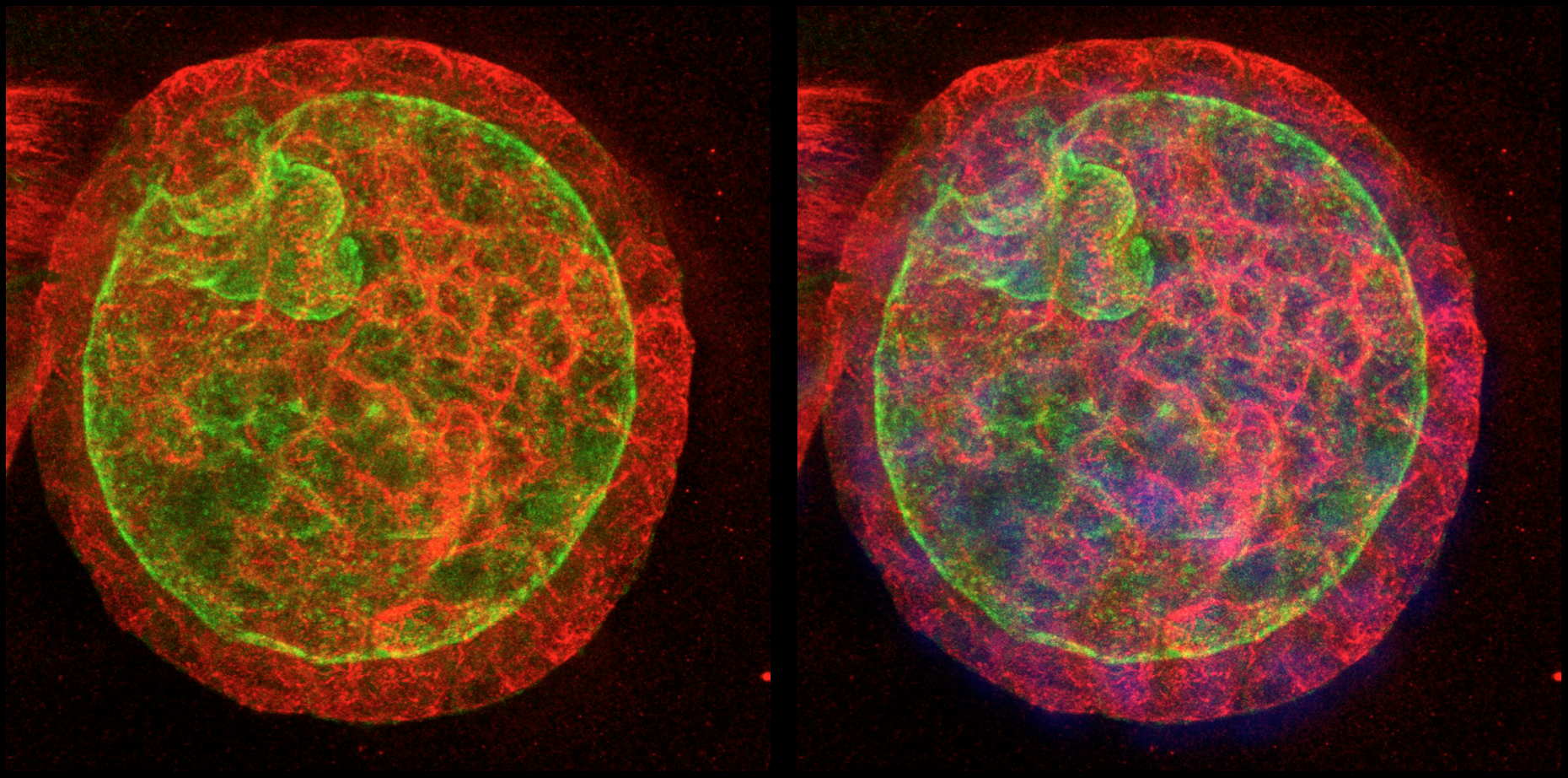 3D MDCK spheroids